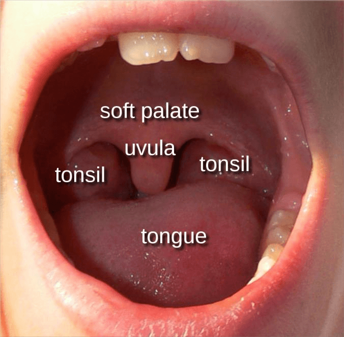 What Are Tonsils And Adenoids Ent 4 Kids